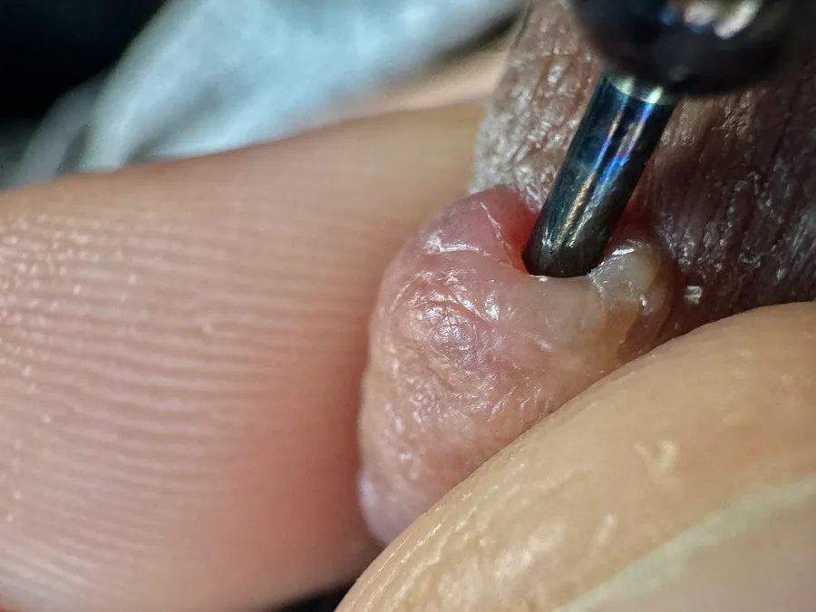 3D Nipple & Areola Tattooing in Melbourne — up close