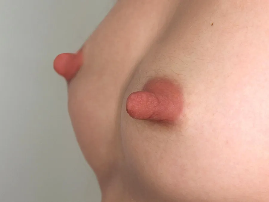 3D Nipple & Areola Tattooing in Melbourne — in practice